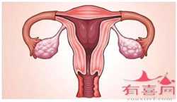 供卵试管生双胞胎花费，乳腺癌的早期症状b超